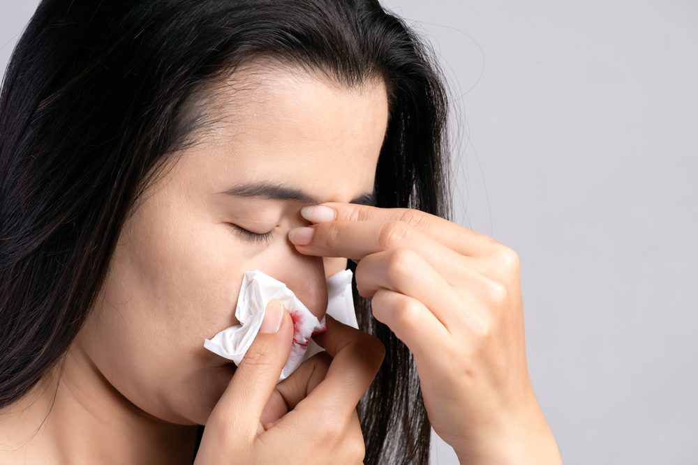 young woman suffering from nose bleeding and using tissue paper for stop bleeding.
